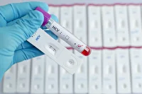 موفقیت طرح آزمایشی حذف هپاتیت C در شیراز